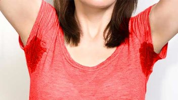 Hyperhidrosis revive clinic