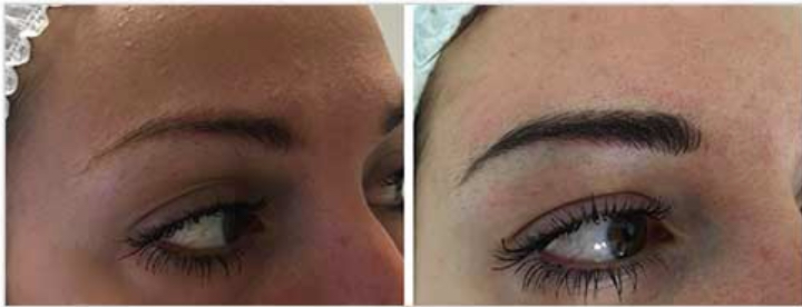 Revive, Aesthetic Skin Clinic, Portlaoise