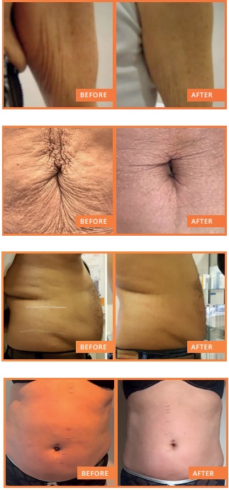 Revive, Aesthetic Skin Clinic, Portlaoise