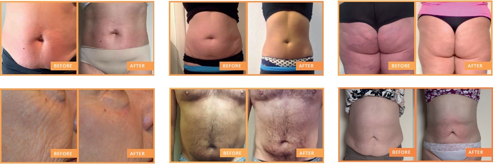 Revive, Aesthetic Skin Clinic, Portlaoise