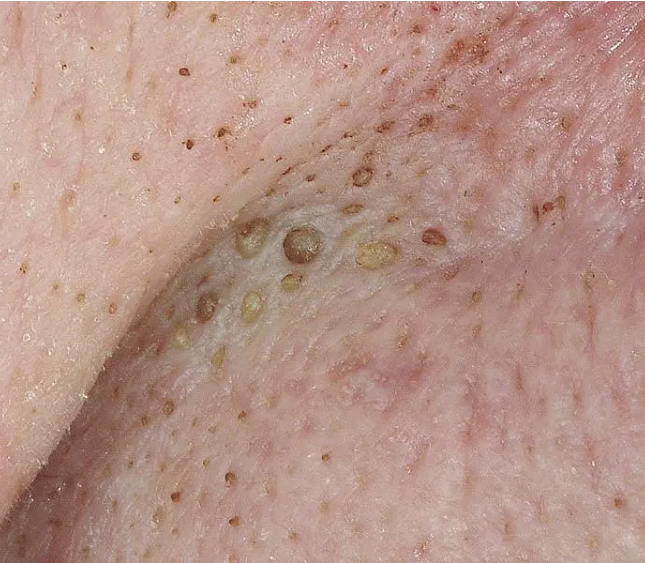 Revive, Aesthetic Skin Clinic, Portlaoise