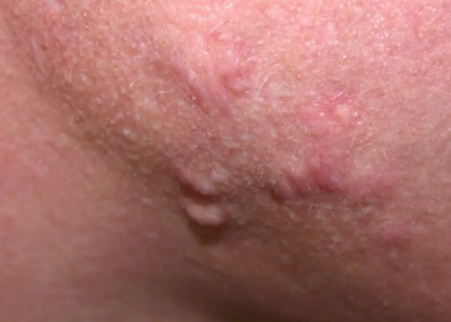 Revive, Aesthetic Skin Clinic, Portlaoise