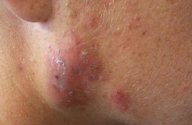 Revive, Aesthetic Skin Clinic, Portlaoise