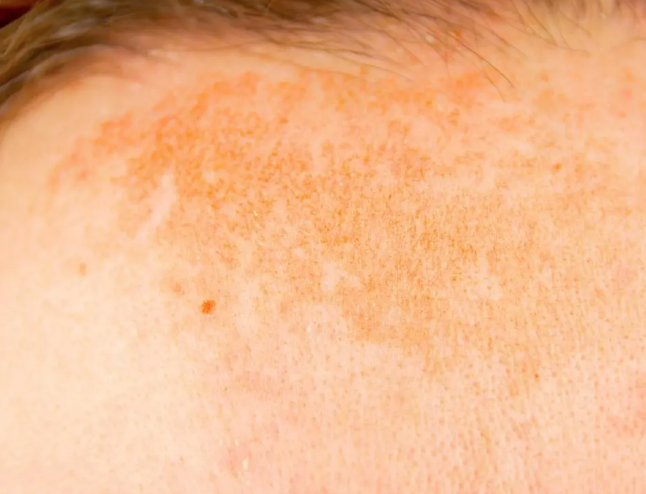 Revive, Aesthetic Skin Clinic, Portlaoise