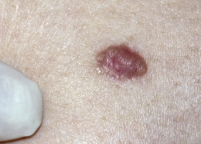 Revive, Aesthetic Skin Clinic, Portlaoise