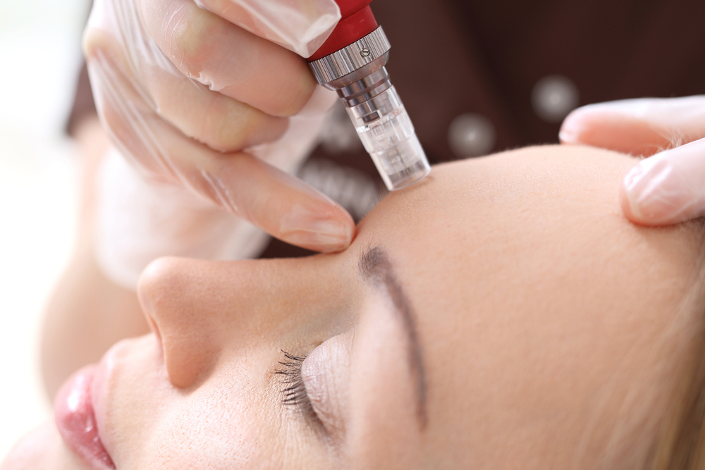Revive, Aesthetic Skin Clinic, Portlaoise